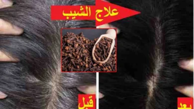 وصفة القرنفل للتخلص من الشيب