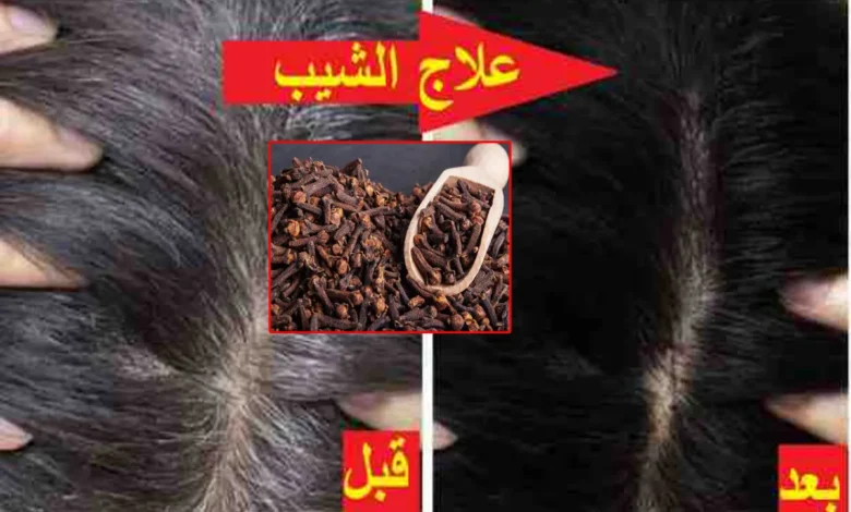 وصفة القرنفل للتخلص من الشيب والشعر الأبيض تماماً نتيجتها رائعة 1 وصفة القرنفل للتخلص من الشيب