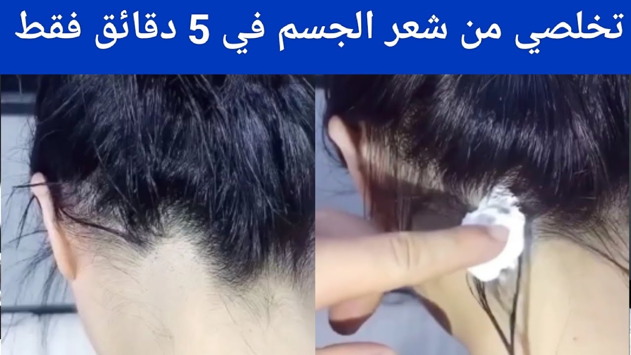 هاتي حبة فازلين وتعالي أقولك إزاي تزيلي شعر الجسم