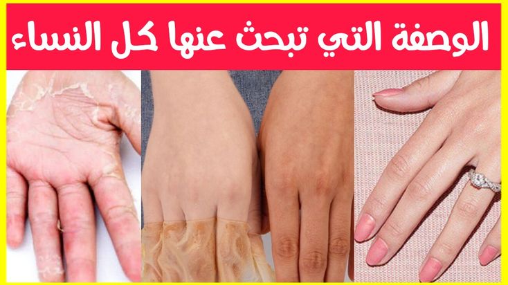 خلطة سحرية لتنعيم الكعبين