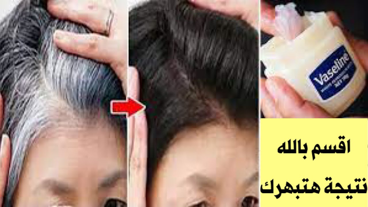وصفة التخلص من الشيب