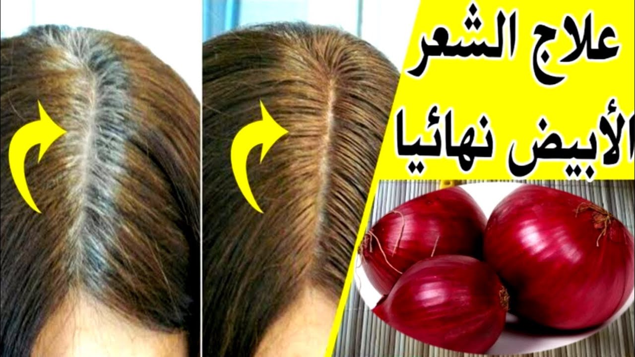 قشر البصل للتخلص من الشيب
