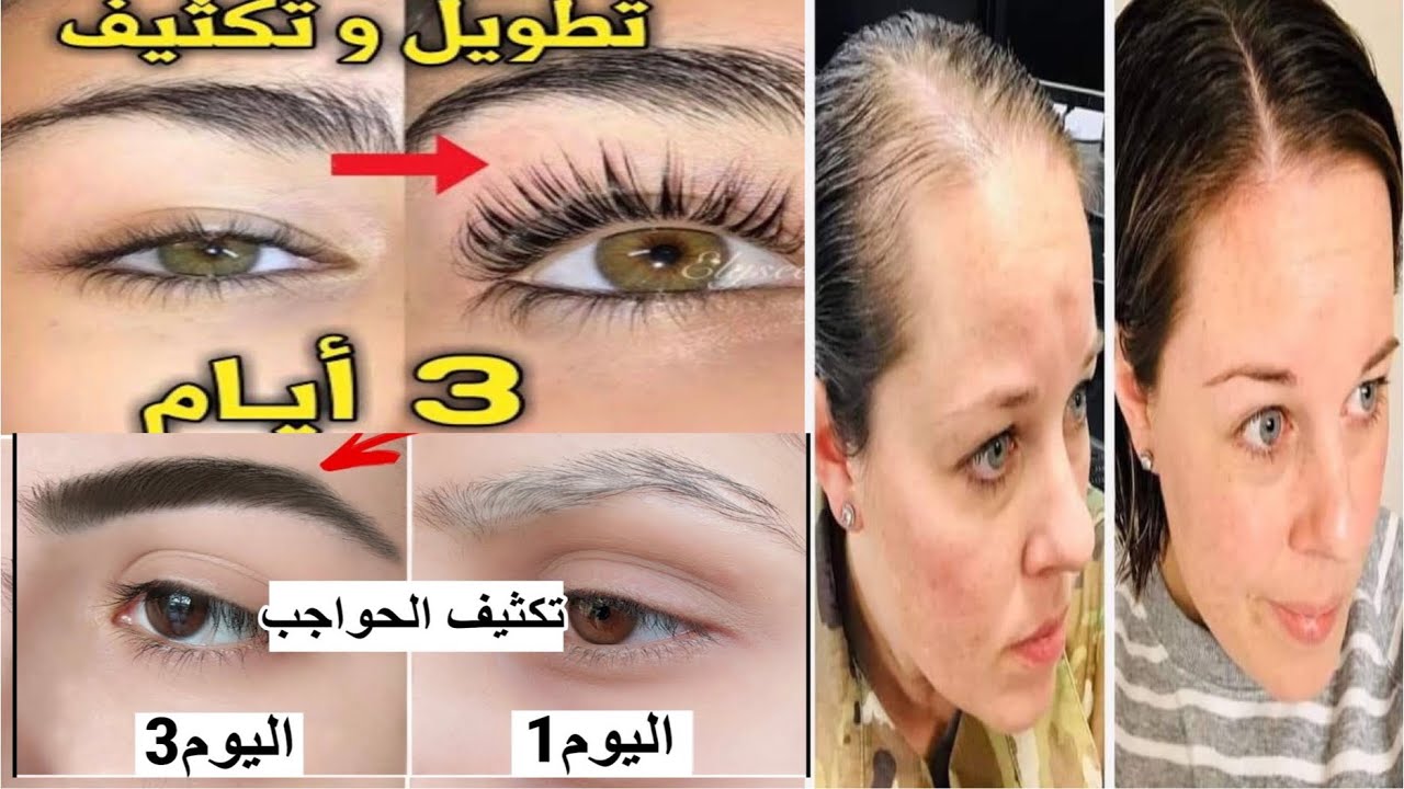 تكثيف الحواجب وإنبات الشعيرات