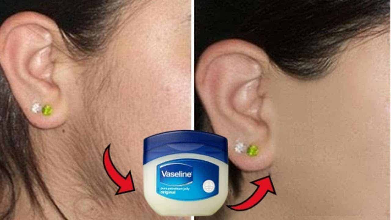 وصفة الفازلين لإزالة شعر الجسم