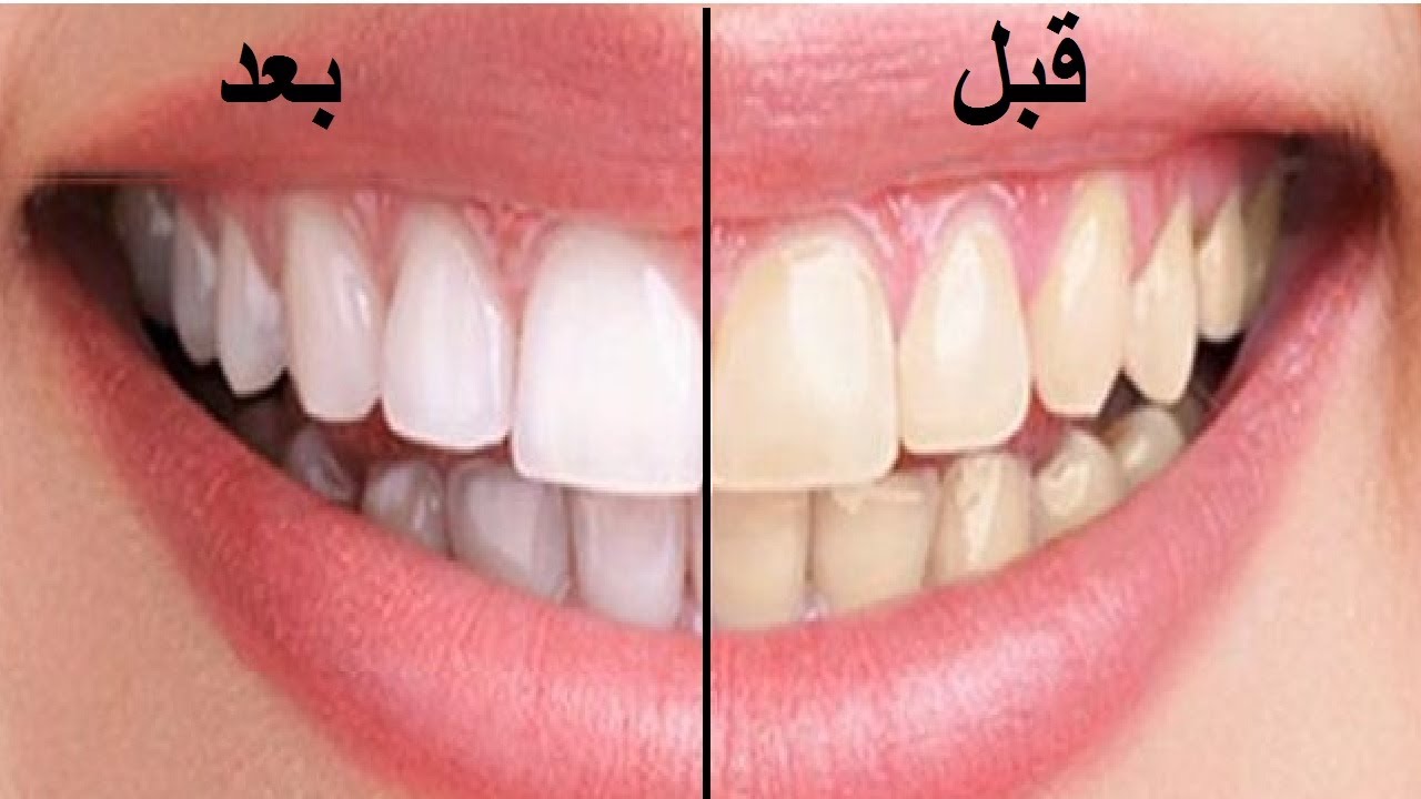 03 04 22 153477413