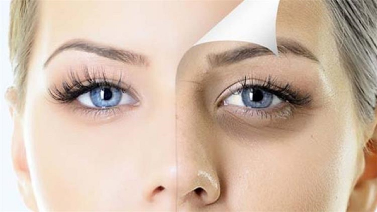 176 172046 causes methods getting rid dark circles under eyes 2