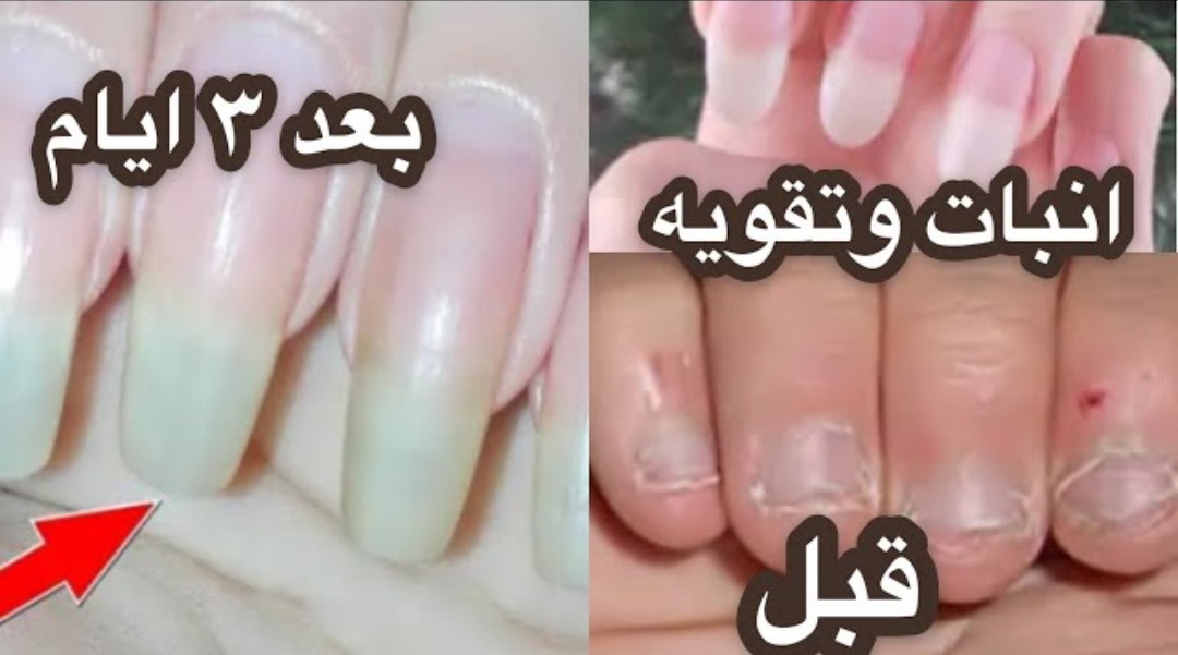 IMG ٢٠٢٢٠٤٢٢ ٠٤٤٦٥٤