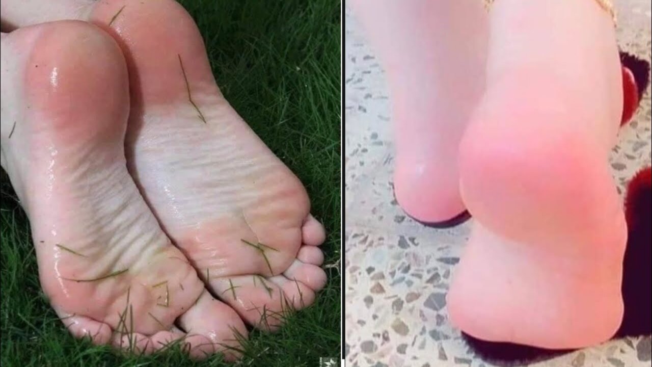 مقشر لليدين والقدمين