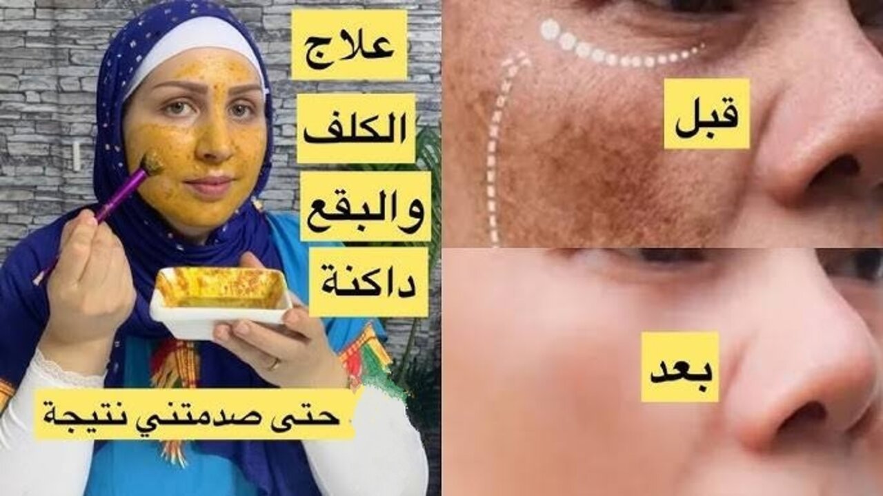 سيروم البشرة