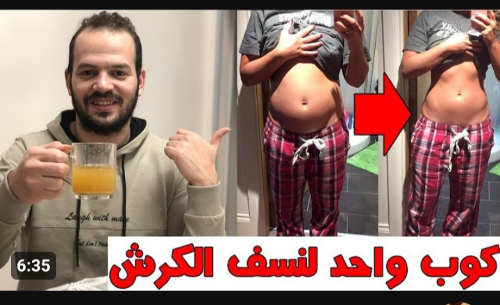 الكرش