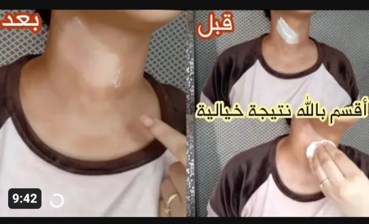 أفضل الوصفات الطبيعية لتفتيح البشرة