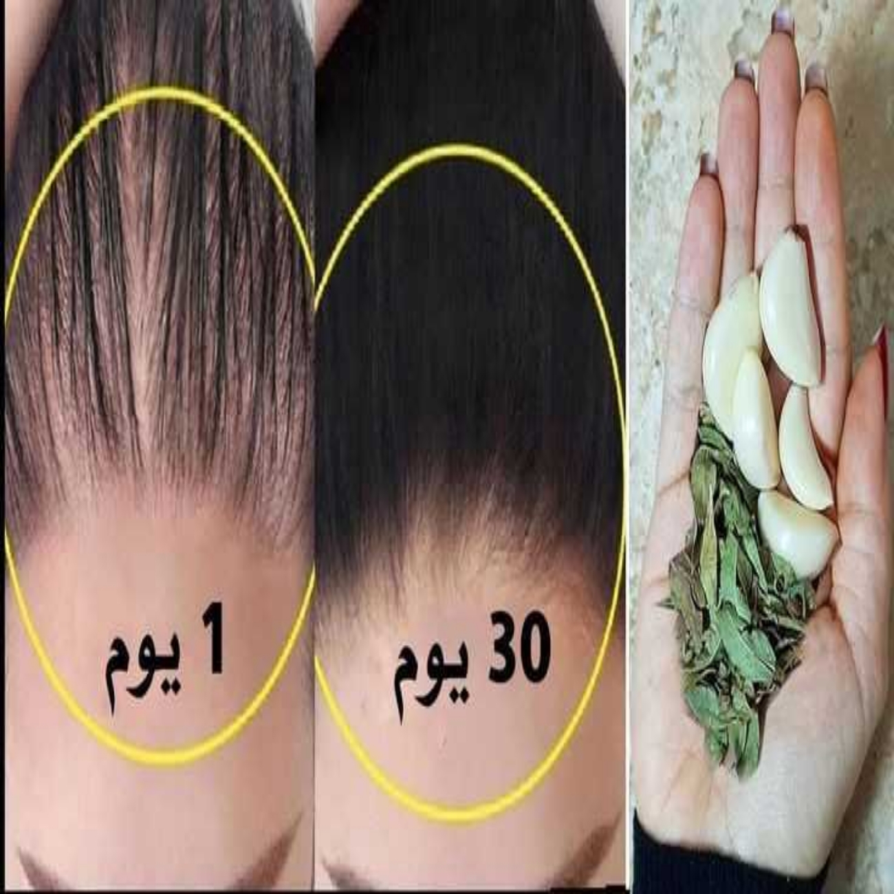 T401699616622420