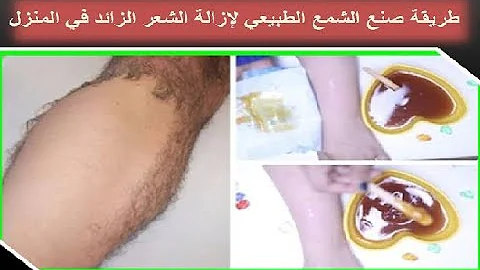 إزالة الشعر