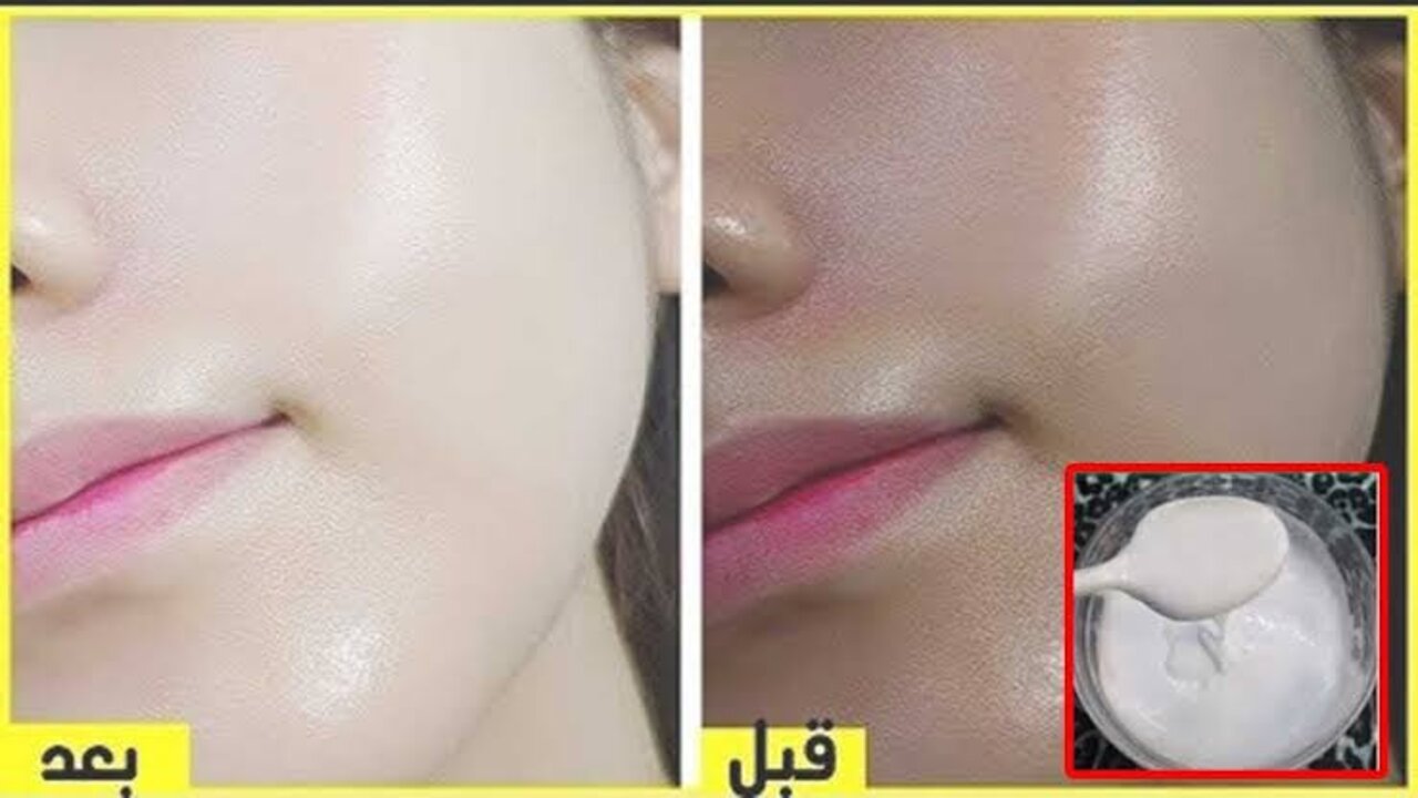 imagesظيكص 1