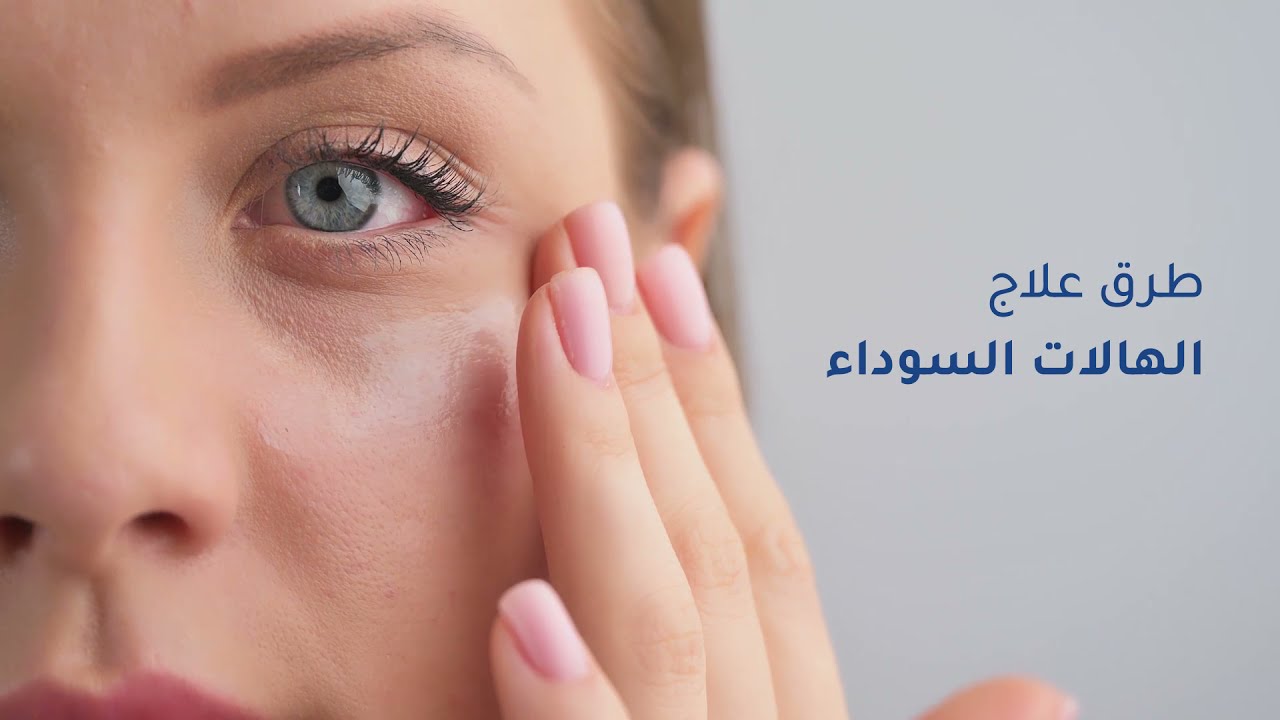 لبان الذكر للهالات السوداء