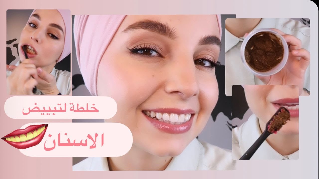 تبييض الأسنان بسرعة