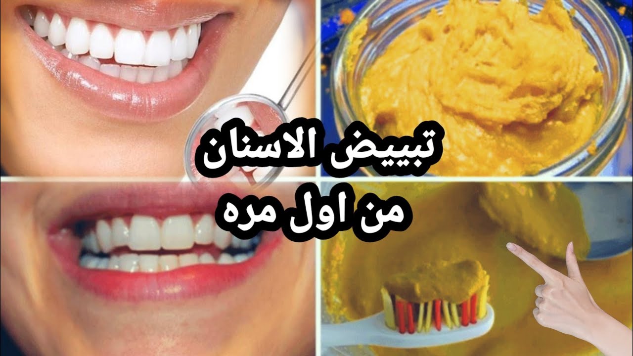 تبييض الاسنان بالكركم
