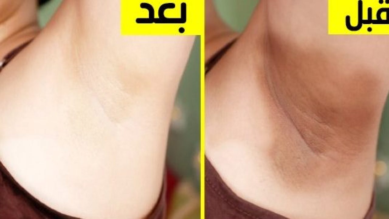 تبييض المناطق الحساسة بالنشا