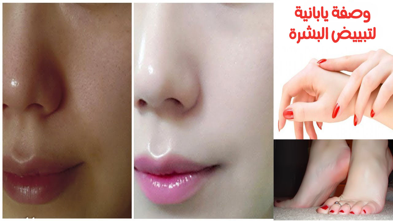 تبييض وتفتيح الوجه وإزالة البقع
