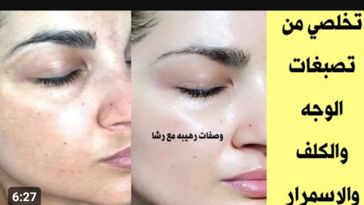 « هتبقى برنسيسة الجيل من النهارده » .. وصفات متقوليش لعدوك عليها هتخلي بشرتك بتلمع وإزالة البقع و التصبغات من الوجه نهائياً اعرفيها فور