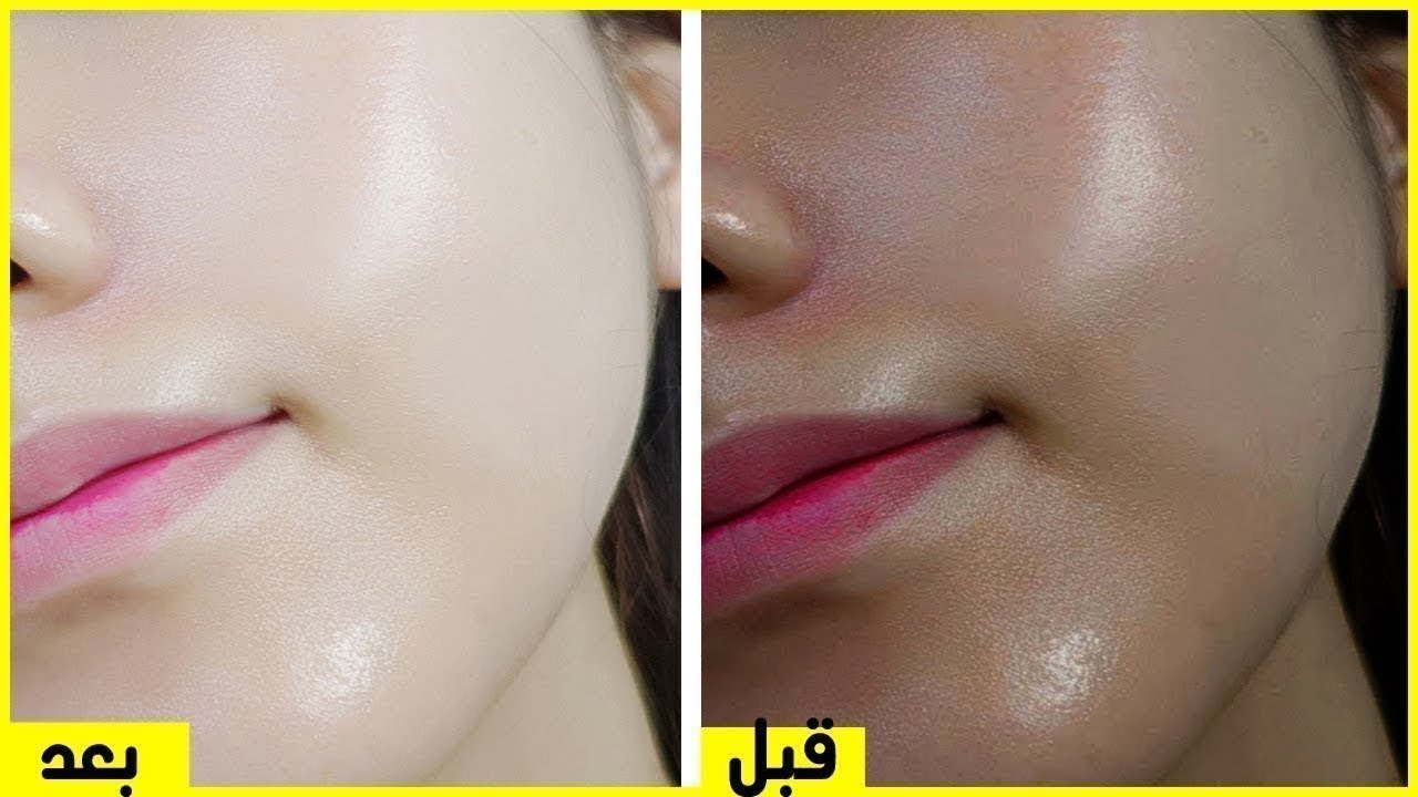 تفتيح البشرة بسرعة فائقة