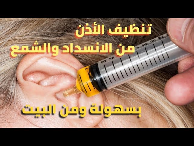 تنظيف الأذن من الشمع