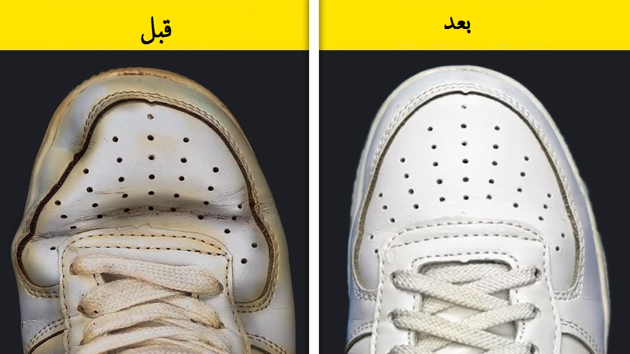 تنظيف الكوتشي الأبيض 4