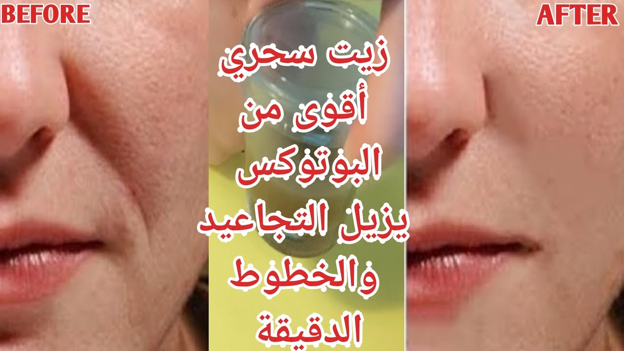زيت سحري للتجاعيد