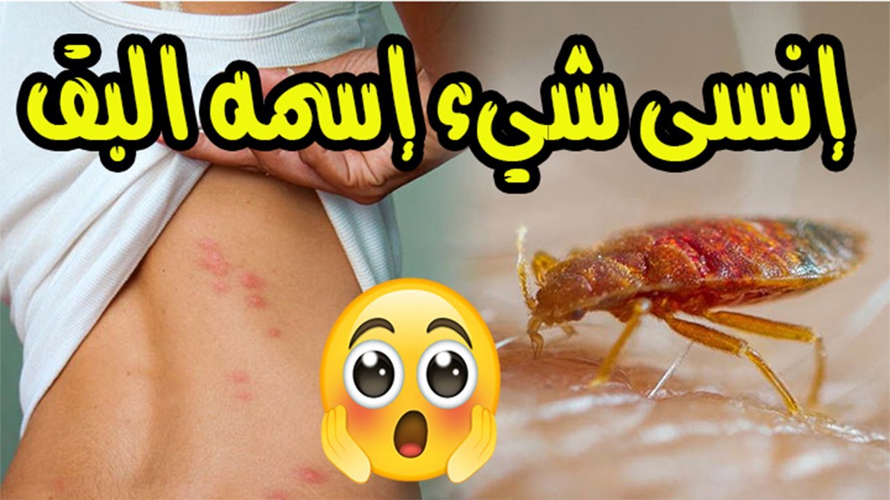 طرق التخلص من البق