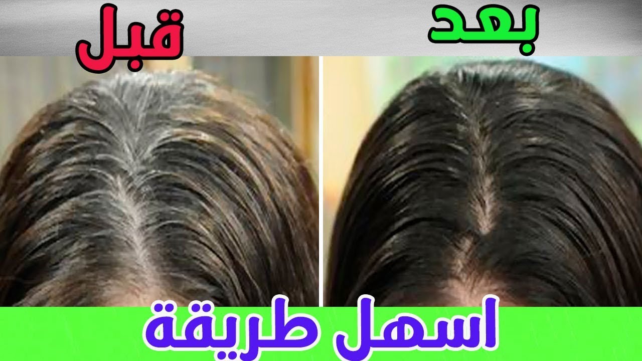 التخلص من الشعر الأبيض بالخميرة