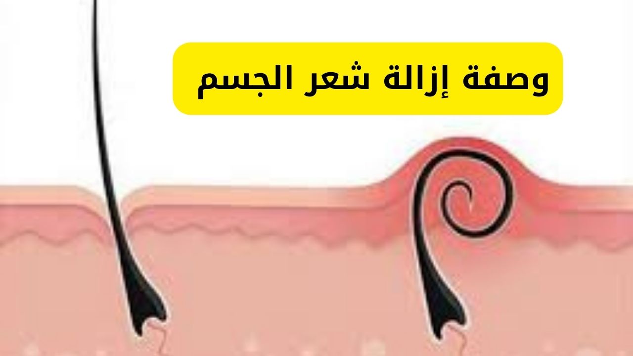 وصفة إزالة شعر الجسم