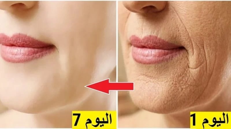بوتوكس طبيعي من البيت