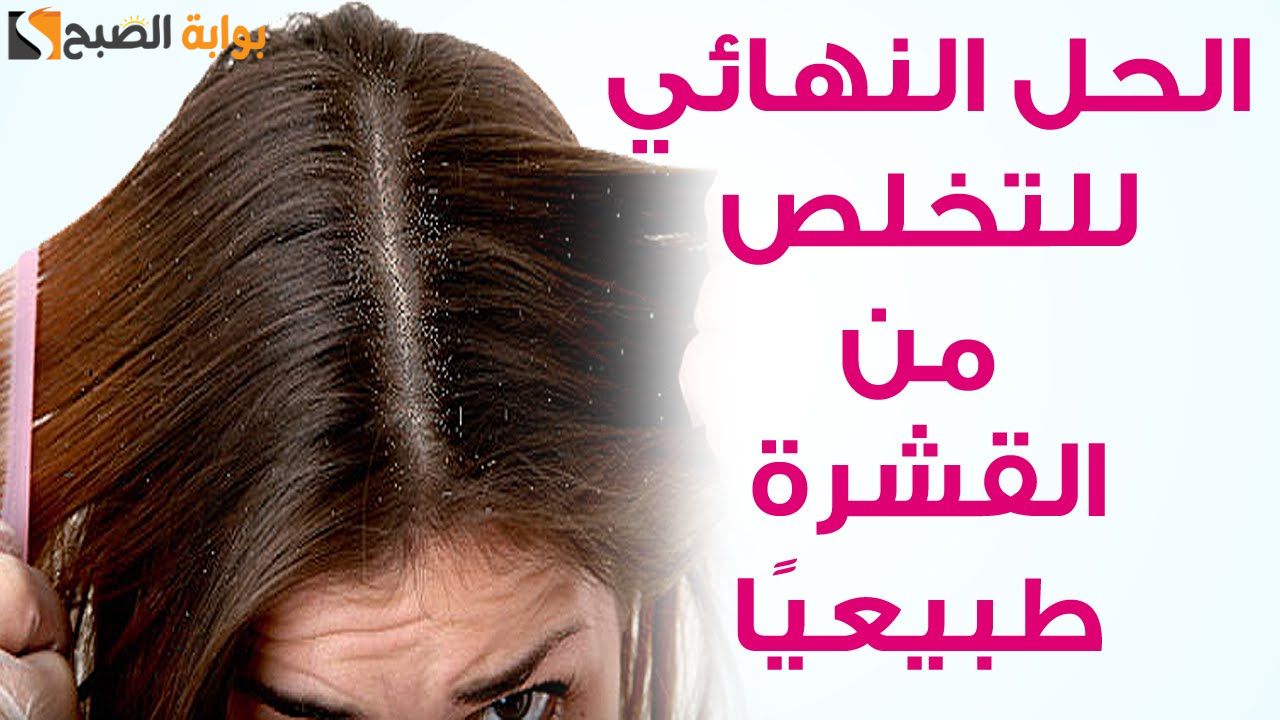 وليه توقعيه لما ممكن تعالجيه.. وصفة طبيعية لعلاج القشرة الموجودة في الشعر مع تقليل التساقط والحكة " النتيجة مضمونة من اول استخدام"