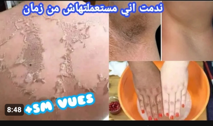 أقوي ماسك مقشر للبشرة الحساسة