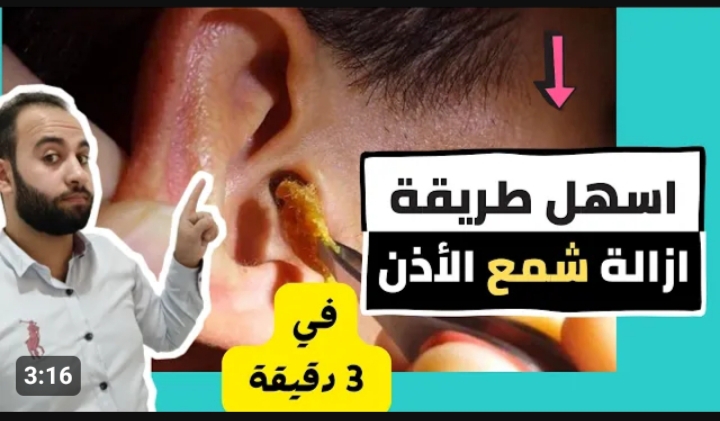 طريقة سهلة لإزالة الشمع من الأذن