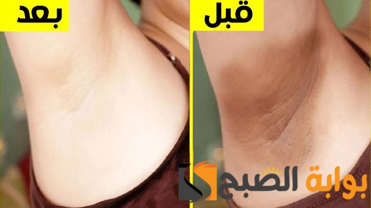 بمكونات اقتصادية وآمنة .... افضل الوصفات الطبيعية للتخلص من اسمرار الإبط