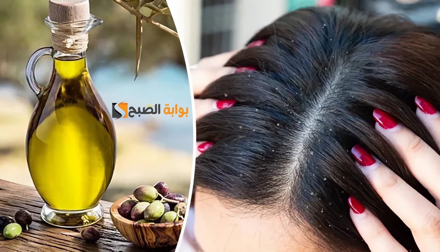 ودعي القشرة للأبد في يومين وبس.. الحل السريع للتخلص من قشرة الشعر بمكونات طبيعية وفي وقت قياسي "هتخلصى من الإحراج نهائيا"