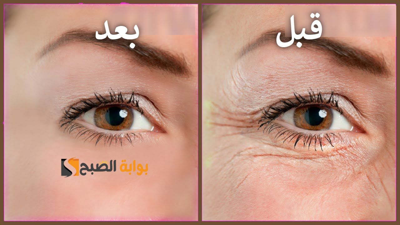 اسرار الكولاجين .. أسرع طريقة لعمل أرخص كولاجين للبشرة يجعلك تبدين أصغر بعشر سنوات "فوائد لا تنتهي لزيت شجرة الشاي"
