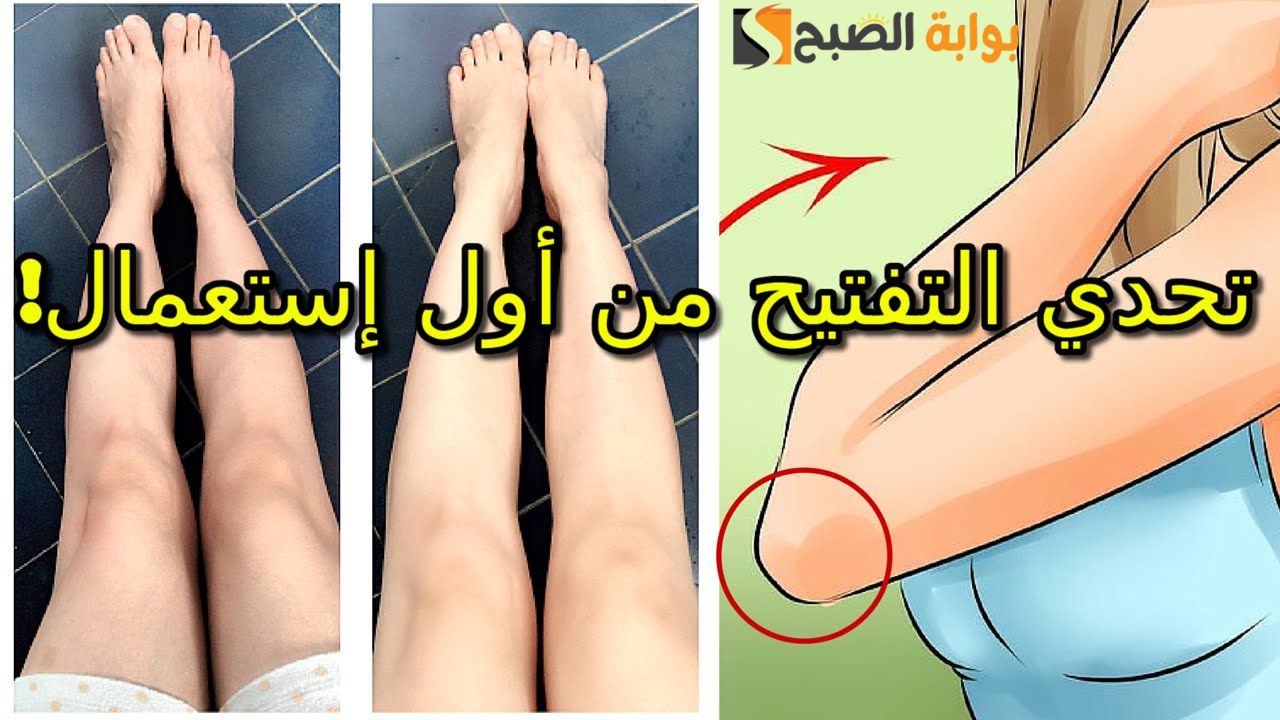 حققي حلمك بـ 10 جنيه .. كريم الليمون مع الفازلين وصفة على قد الإيد لتفتيح الركب والأكواع في أقل من أسبوع '' رجلك هتنور من البياض"