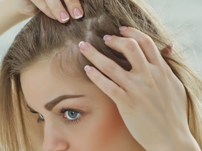 3 وصفات لإنبات البيبي هير جربيها