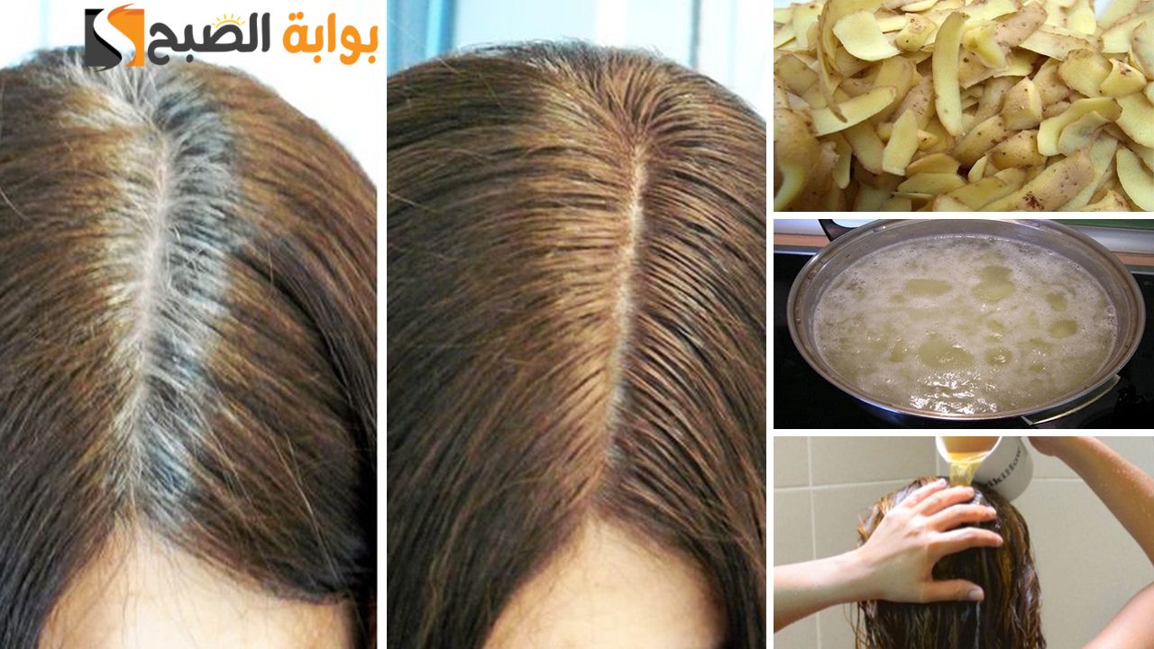 كنز في بيتك وأغلى من الذهب.. وصفة قشر البطاطس هتحللك نص مشاكل شعرك '' مش هترمي القشر مرة تانية"
