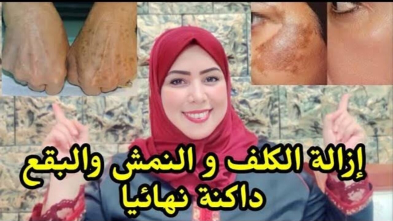 وصفة الشوفان لإزالة الكلف