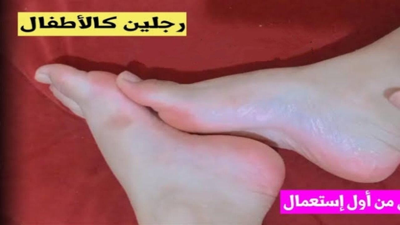 وصفة صودا الخبز لتقشير القدمين