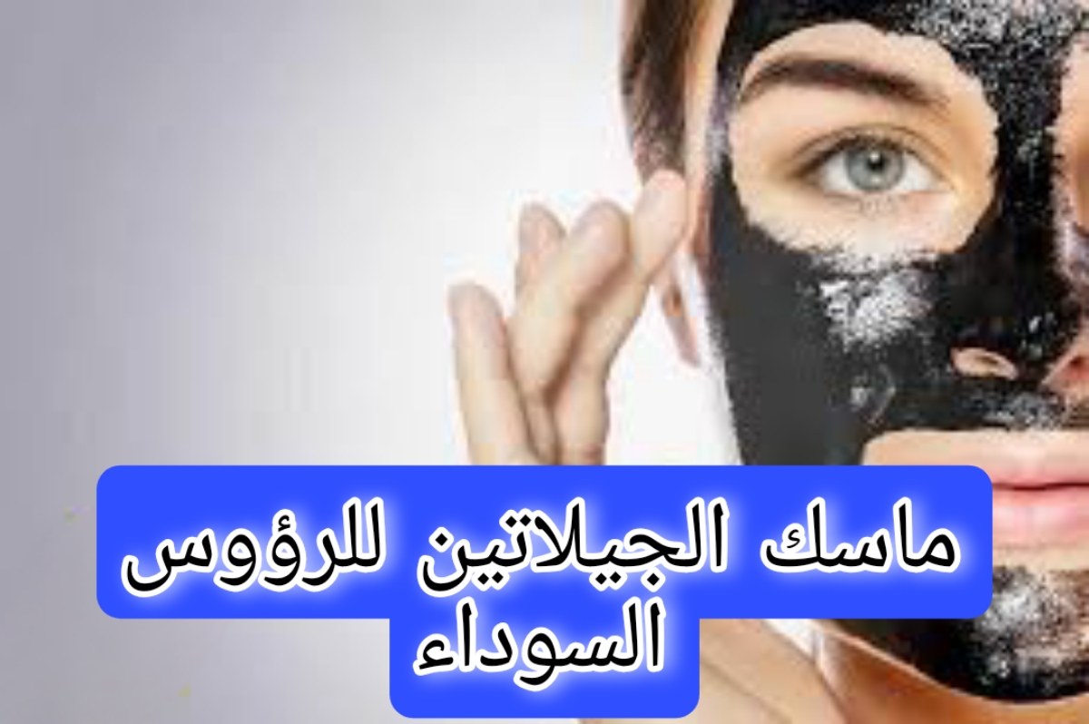 ماسك الجيلاتين للرؤوس السوداء
