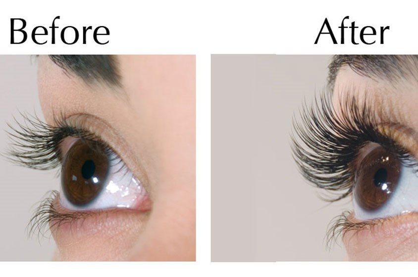 before and after1