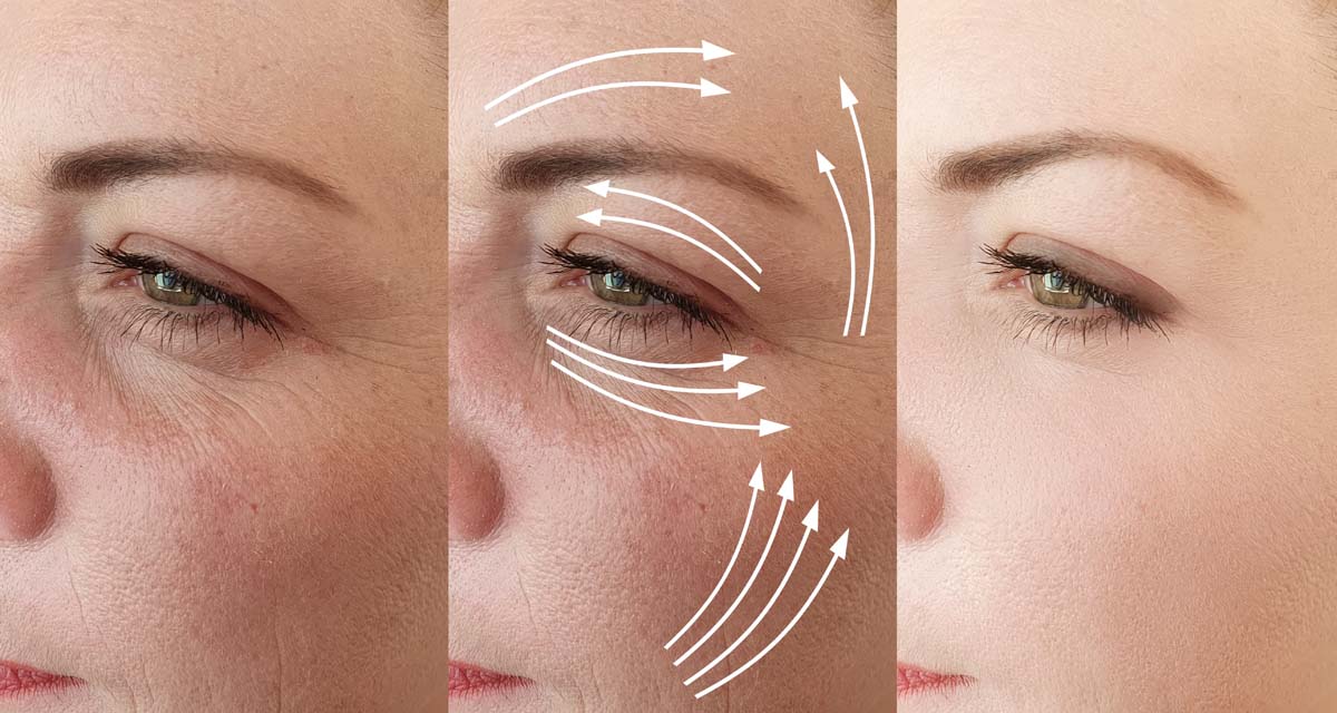 face tightening in riyadh 2166988801