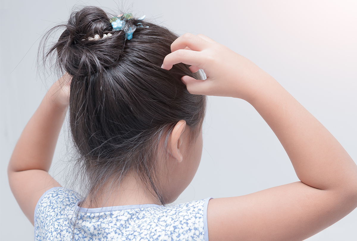 head lice home remedy feat 1