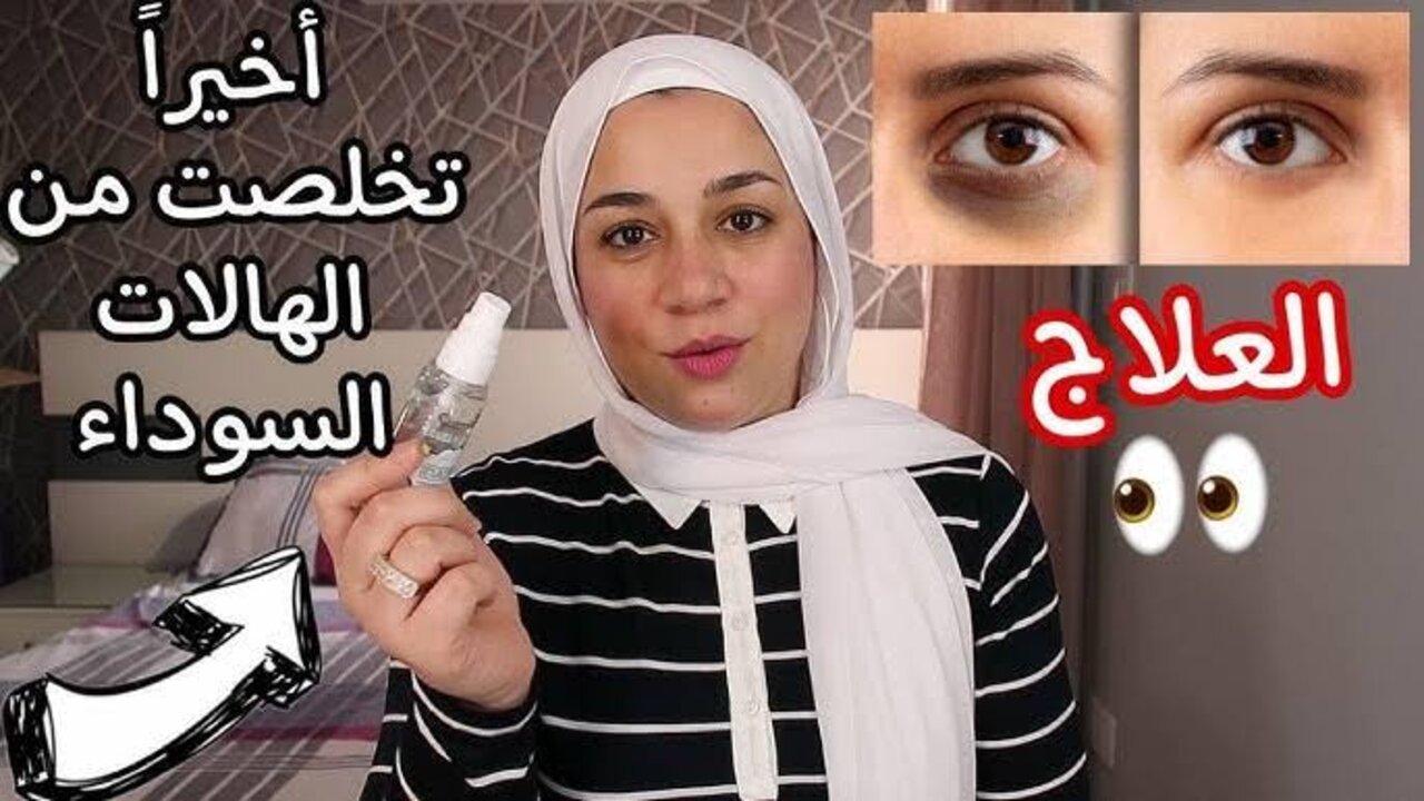 وصفة عرق السوس للهالات السوداء