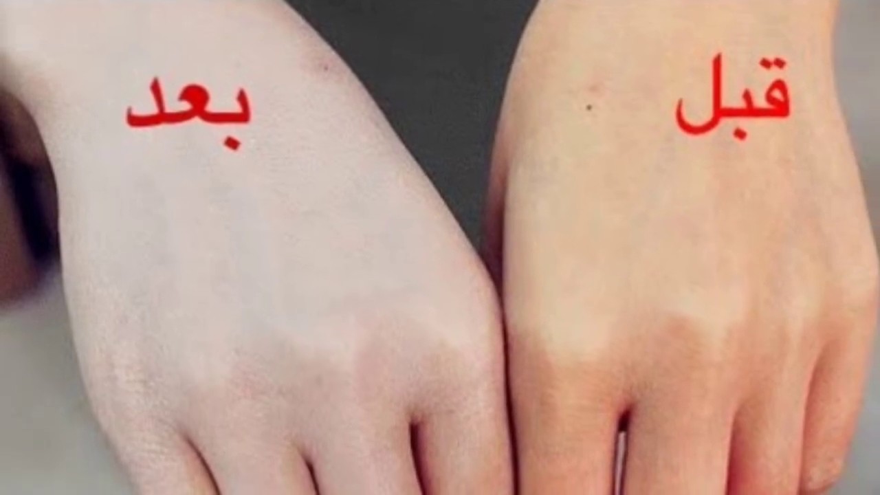 وصفات تبيض الجسم والتخلص من البقع الداكنة بمكونات بسيطة