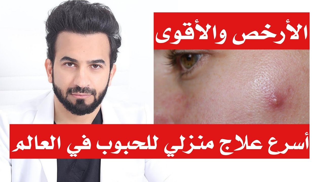 علاج حبوب البشرة الدهنية